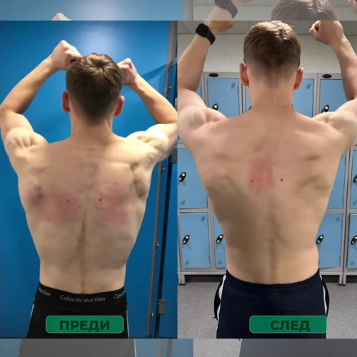 Коректор за стойка – Стой изправен. Облекчи гърба си. Усети разликата още от първия ден.