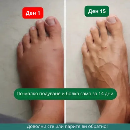 Zenstride® Дишащи компресионни чорапи за крака и стъпала без болка